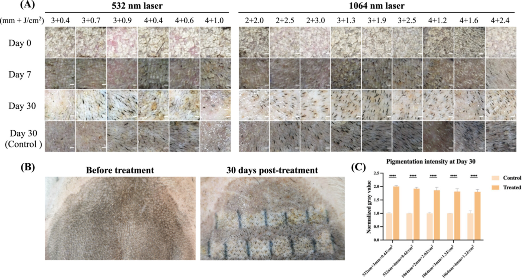 Photographs of dark pigmented porcine hip skin after picosecond laser treatment with different wavelengths, spot sizes, and fluences